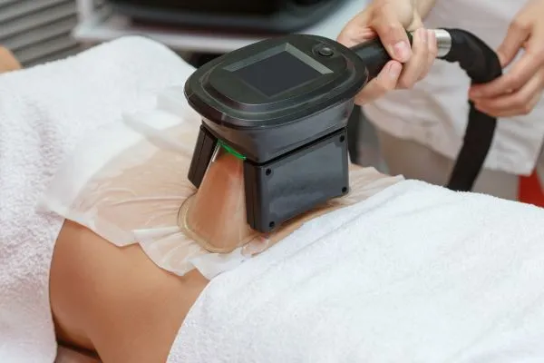 Image of person having fat freezing treatment to help weight gain Duddingston