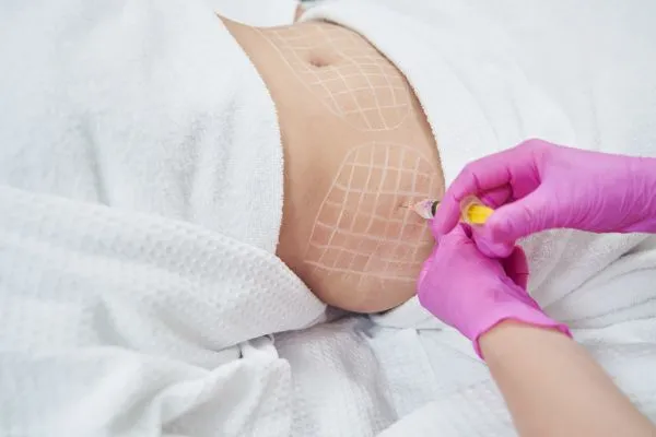 image of fat dissolving injections on love handles to help combat weight gain Duddingston