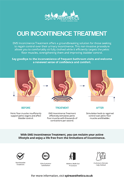image of how urge incontinence Duddingston treatment works