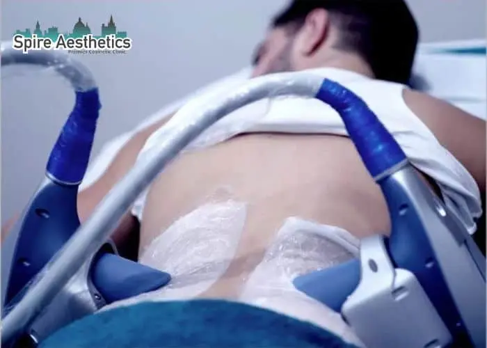 Man having fat freezing treatment done on love handles before a competitions Duddingston to create a sculpted look.