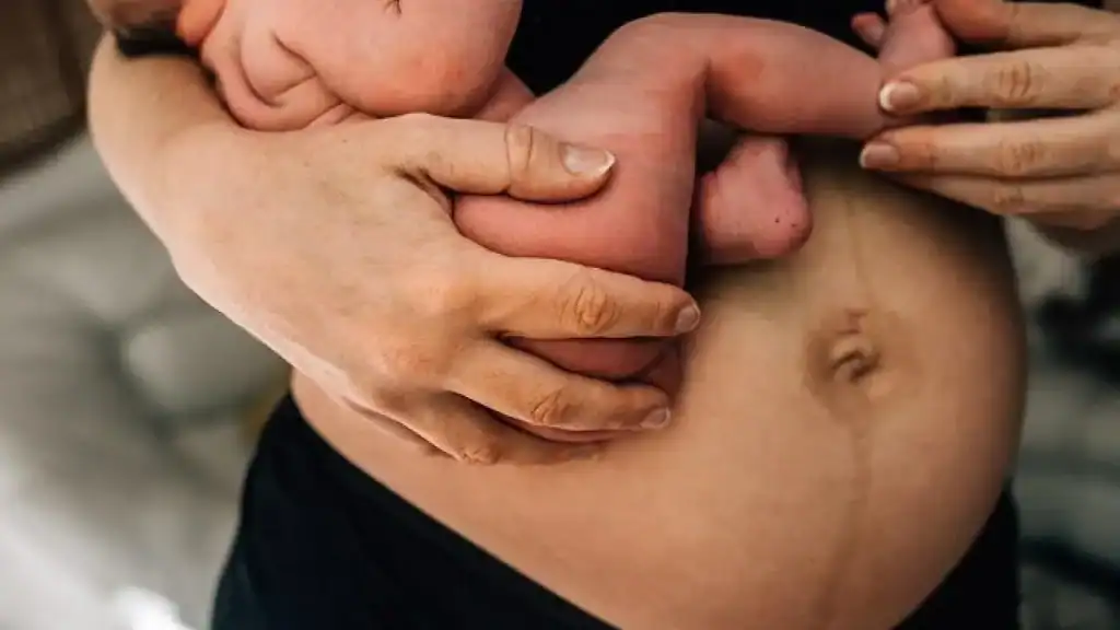 Why Is My Stomach Still Big After Pregnancy Duddingston?
